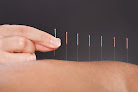 Prenatal Care Clinics in Bothell 1 Negocio Acupuncture And Natural Healing