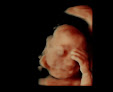 Prenatal Care Clinics in Modesto 2 Negocio Babyface Ultrasound Studio & Boutique