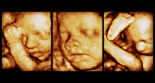 Prenatal Care Clinics in Feasterville-Trevose 1 Negocio Bond Before Birth 3d/4d Ultrasound