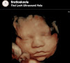 First Look Nola 3d/4d Ultrasound – Prenatal Care Clinic In Kenner 1 First Look Nola 3d/4d Ultrasound