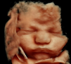 Itty Bitty Ultrasounds - 3d/4d Ultrasound Studio
