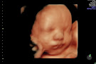 Life In Bloom Sonography Studio | Lincoln, Ne