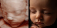 Little Bellies Ultrasound & Pregnancy Spa – Prenatal Care Clinic In Lenexa 1 Little Bellies Ultrasound & Pregnancy Spa