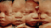 Negocio Peekaboo3d