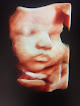 Prenatal Care Clinics in Killen 1 Negocio Stork's Secret
