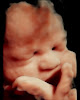 Ultrasound Specialists Of Nm / Mom To Be 3d4d – Prenatal Care Clinic In Albuquerque 1 Ultrasound Specialists Of Nm / Mom To Be 3d4d