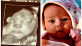 Watch Me Grow Studio – Prenatal Care Clinic In Zanesville 1 Watch Me Grow Studio