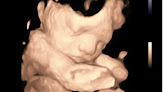 Negocio Watching Me Grow Ultrasounds Llc, 3d/4d Prenatal Ultrasounds