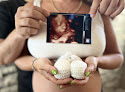 Prenatal Care Clinics in Staten Island 1 Negocio Wonderful Reveals 3d Ultrasound Maternity & Newborn Photography Si& Nj