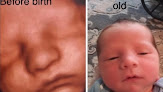 Negocio Wonderful Reveals 3d Ultrasound Maternity & Newborn Photography